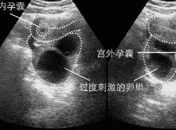 青海省三代试管助孕机构_青海西宁助孕公司_西宁市正规助孕中心